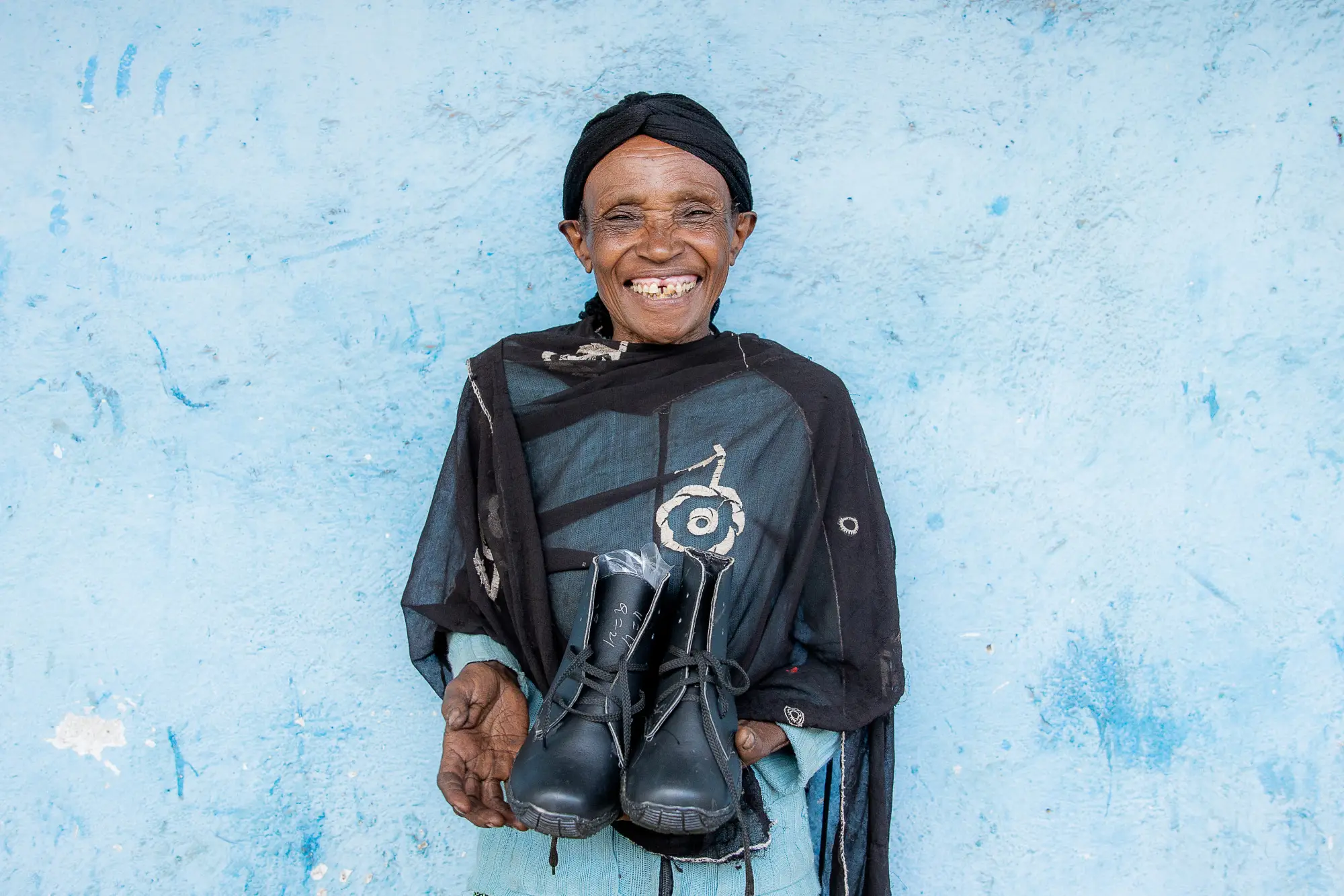Aberash Albae poses with large sized shoes, specially adapted to podoconiosis  patients at Sholla Kodo Health Center Youth Friendly Health Service Center, Ofa woreda, Sodo zuriya, Wolayita, Southern Ethiopia regional state.