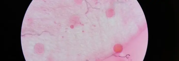 201602261145 14 oocyst examination 2