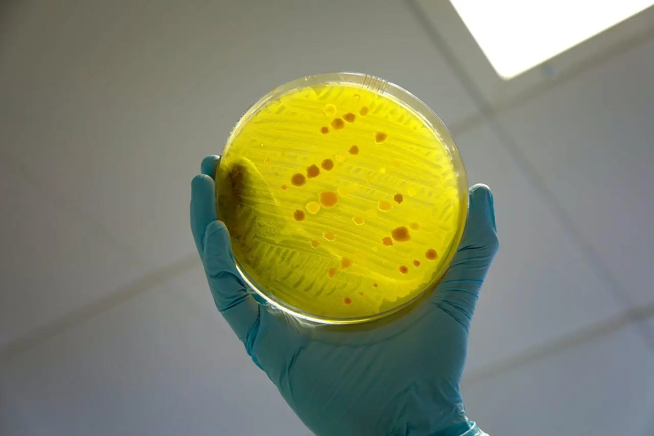 11200959 98 avarietyofdifferentbacteriatestingforantimicrobialresistance