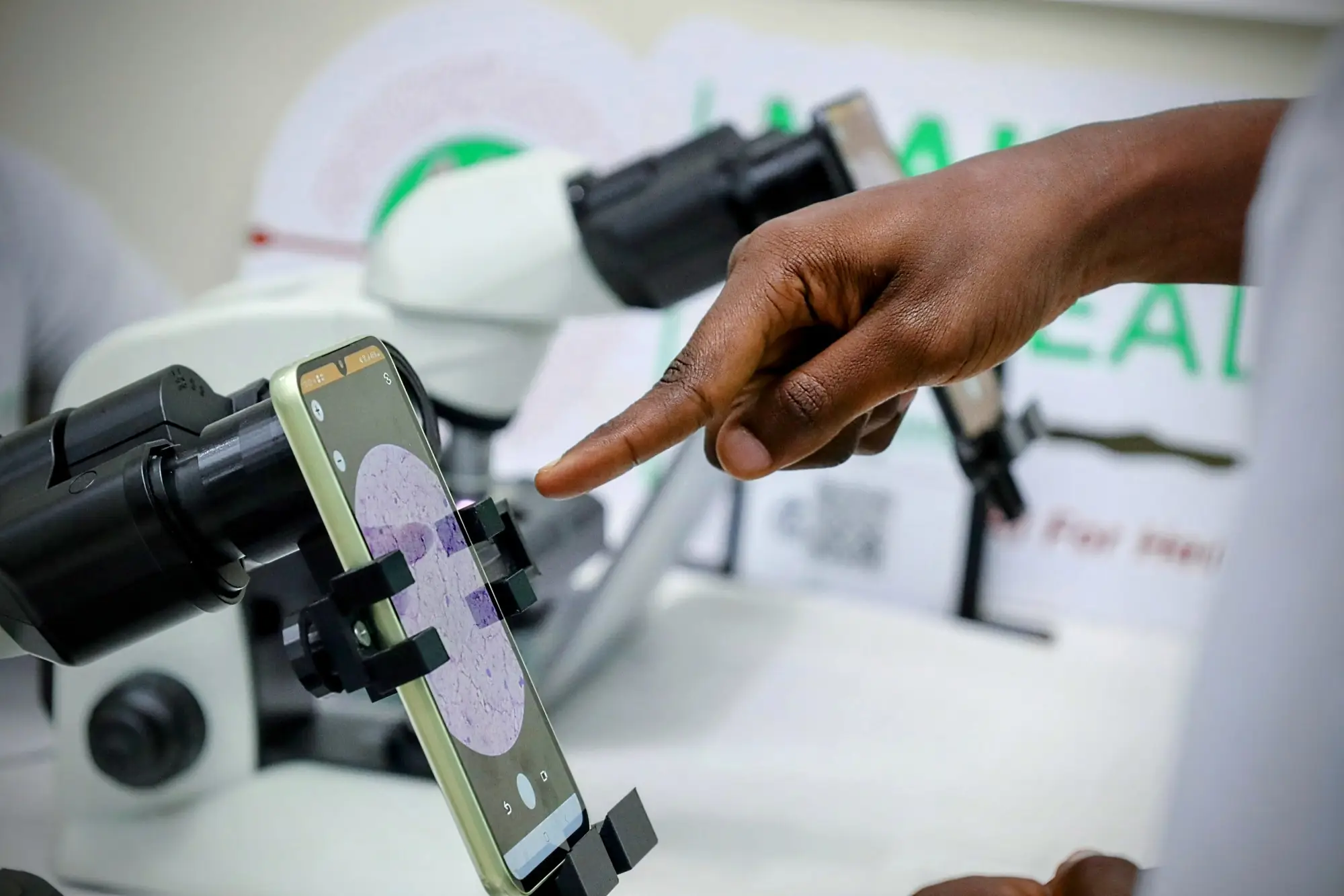 Close-up of Ocular’s 3D-printed adapter transforming any smartphone and microscope into an AI diagnostic tool
