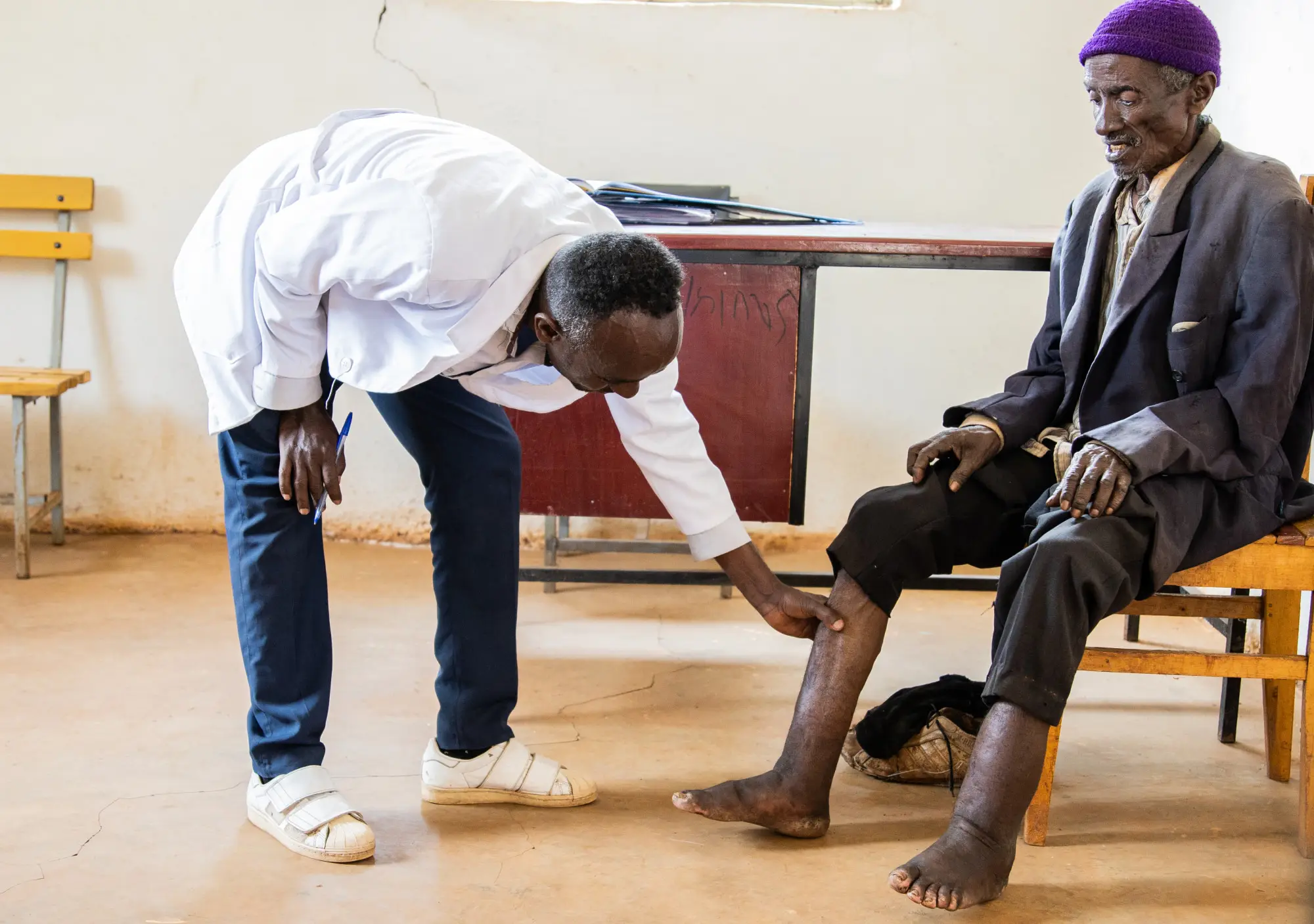 Mesfin Bergenae, health worker, treating a podoconiosis patient at Sholla Kodo Health Center Youth Friendly Health Service Center, Ofa woreda, Sodo zuriya, Wolayita, Southern Ethiopia regional state