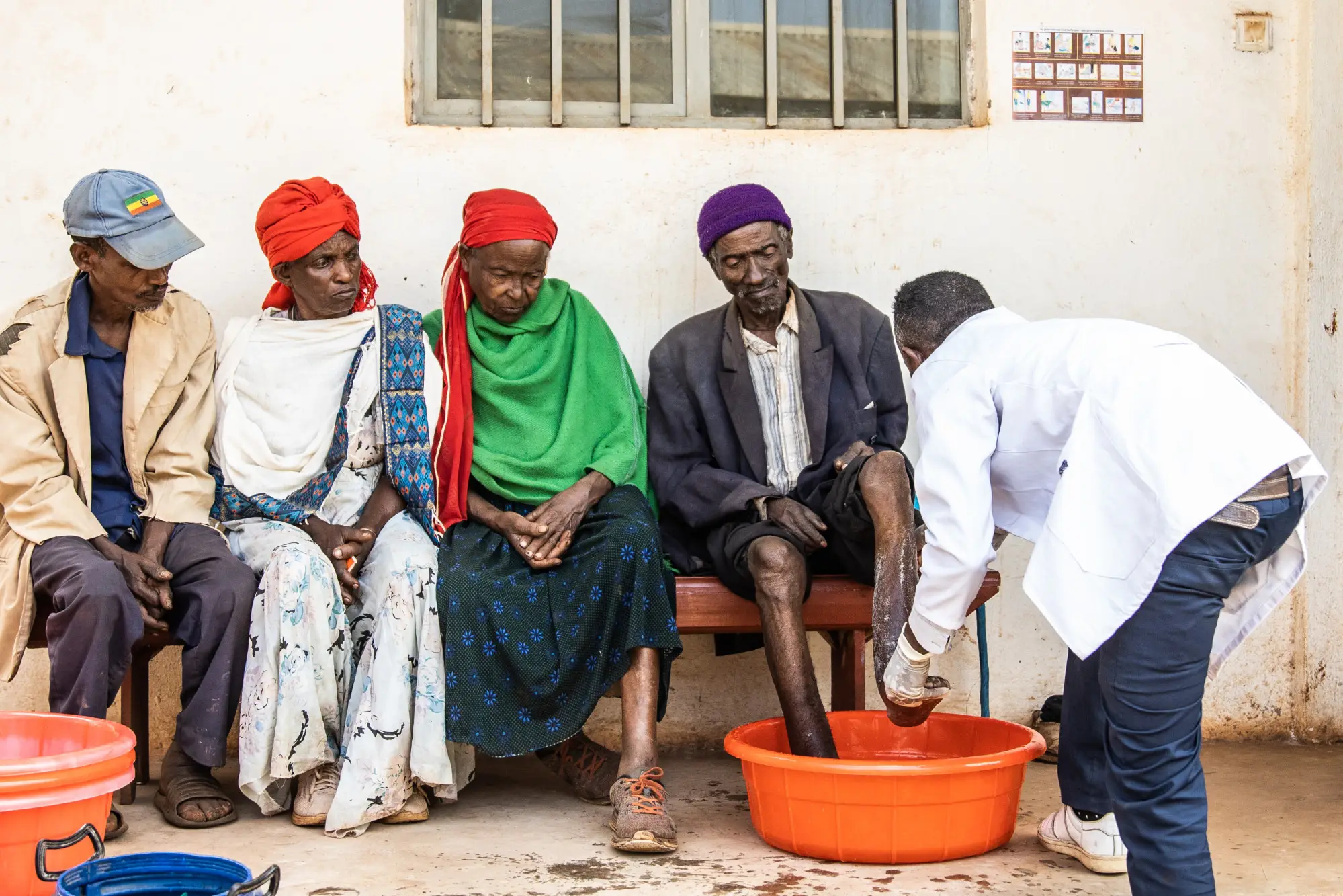 Mesfin Bergenae, health worker,  demonstrates foot hygiene to podoconiosis patients  at  Sholla Kodo Health Center Youth Friendly Health Service Center, Ofa woreda, Sodo zuriya, Wolayita, Southern Ethiopia regional state