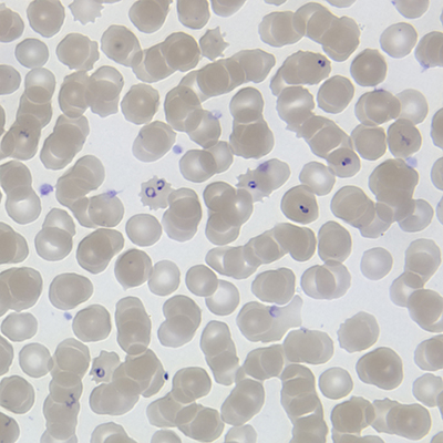 Plasmodium falciparum in blood cells - Parasite (By MichaelZahniser (Own work) [Public domain], via Wikimedia Commons
