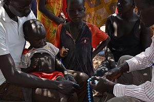 Photo for Sharing progress and lessons learnt from the pneumonia diagnostics project in South Sudan