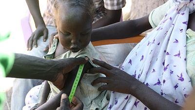 At another site, a young girl’s arm is measured. This measurement, taken in conjunction with the circumference of her arm, her height and her weight, can be used to determine her nutritional status. The community health workers are trained in how to carry out this process, provided with the tools and supported in carrying out their work