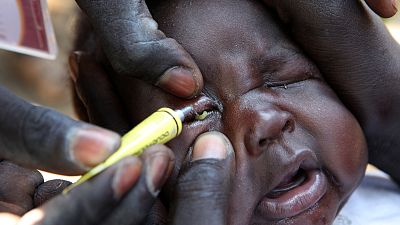 With the help of the child’s mother, Malaria Consortium Community Drug Distributor administers the preventative antibiotic for trachoma to three-month old Wuor Majak's eyes in Kalakalak village, Unity State, South Sudan. If left untreated, trachoma can keep families in a continual cycle of poverty with the disease and its long-term effects are transferred from one generation to the next. Across the world, trachoma leads to an estimated $2.9 billion in lost productivity every year.